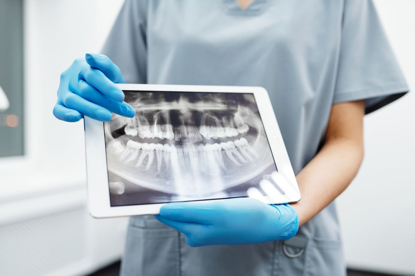 Radiografia panorâmica dos dentes apresentada em um tablet