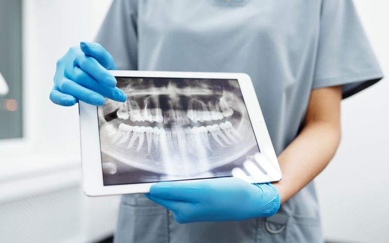 Radiografia panorâmica dos dentes apresentada em um tablet