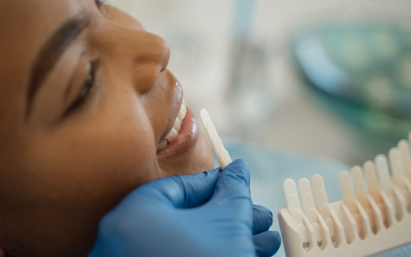 Seleção de cor dos dentes com escala de tonalidades